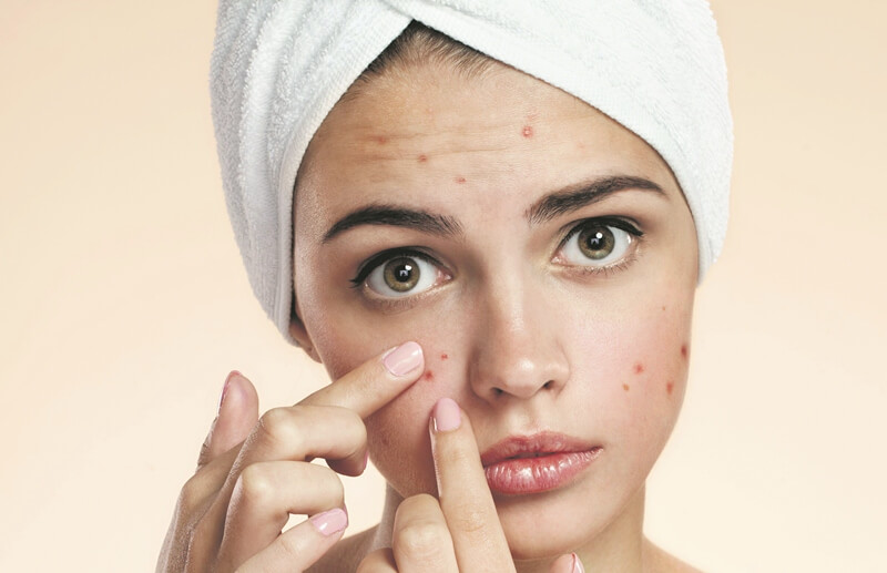 ΑΚΜΗ: Συμβουλές για την αντιμετώπισή της