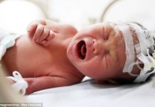 Η γέννα με καισαρική βλάπτει τα μωρά