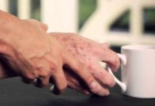 Πώς η καφεΐνη σχετίζεται με την ασθένεια Πάρκισον