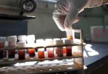 Πρόωρος Τοκετούς: Νέο τεστ αίματος σε εγκύους προβλέπει τον πρόωρο τοκετό