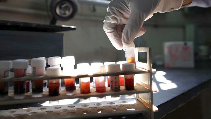 Πρόωρος Τοκετούς: Νέο τεστ αίματος σε εγκύους προβλέπει τον πρόωρο τοκετό