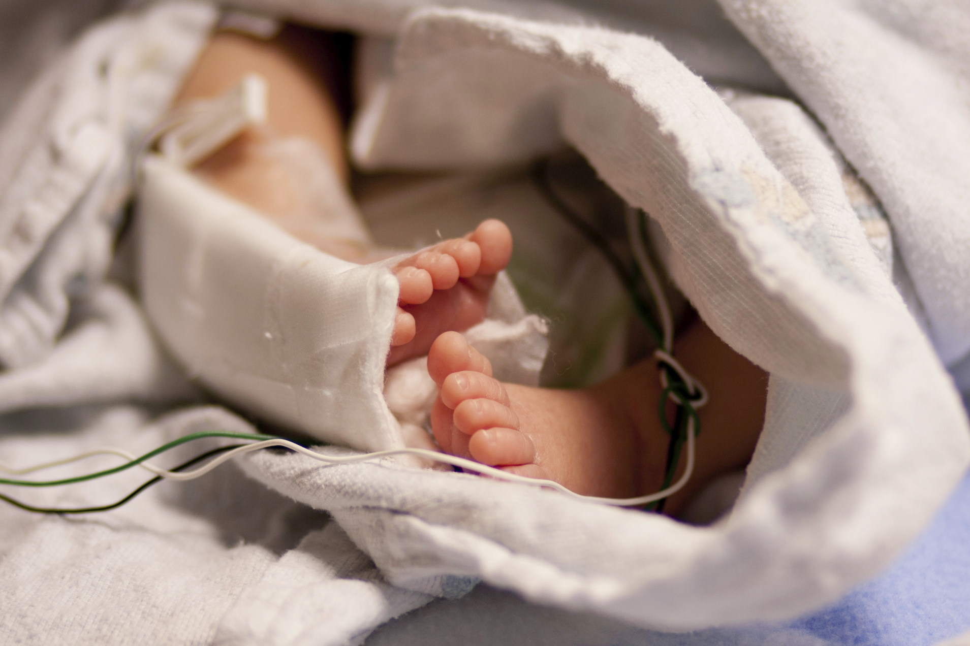 Νεογνό υπέστη σπάνια επέμβαση στο Ωνάσειο Καρδιοχειρουργικό Κέντρο