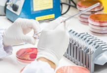 Έλληνας ογκολόγος «αναβάθμισε» το τεστ Παπ για την έγκαιρη διάγνωση καρκίνου