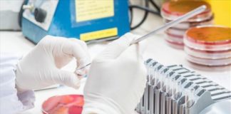 Έλληνας ογκολόγος «αναβάθμισε» το τεστ Παπ για την έγκαιρη διάγνωση καρκίνου