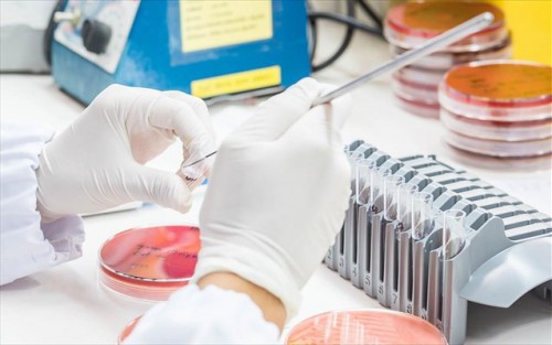 Έλληνας ογκολόγος «αναβάθμισε» το τεστ Παπ για την έγκαιρη διάγνωση καρκίνου