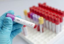 Σχεδόν 300 εκατ. άνθρωποι νοσούν από ηπατίτιδα Β - Τι ισχύει στην Ελλάδα;