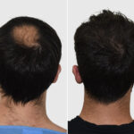 result5-before-after1